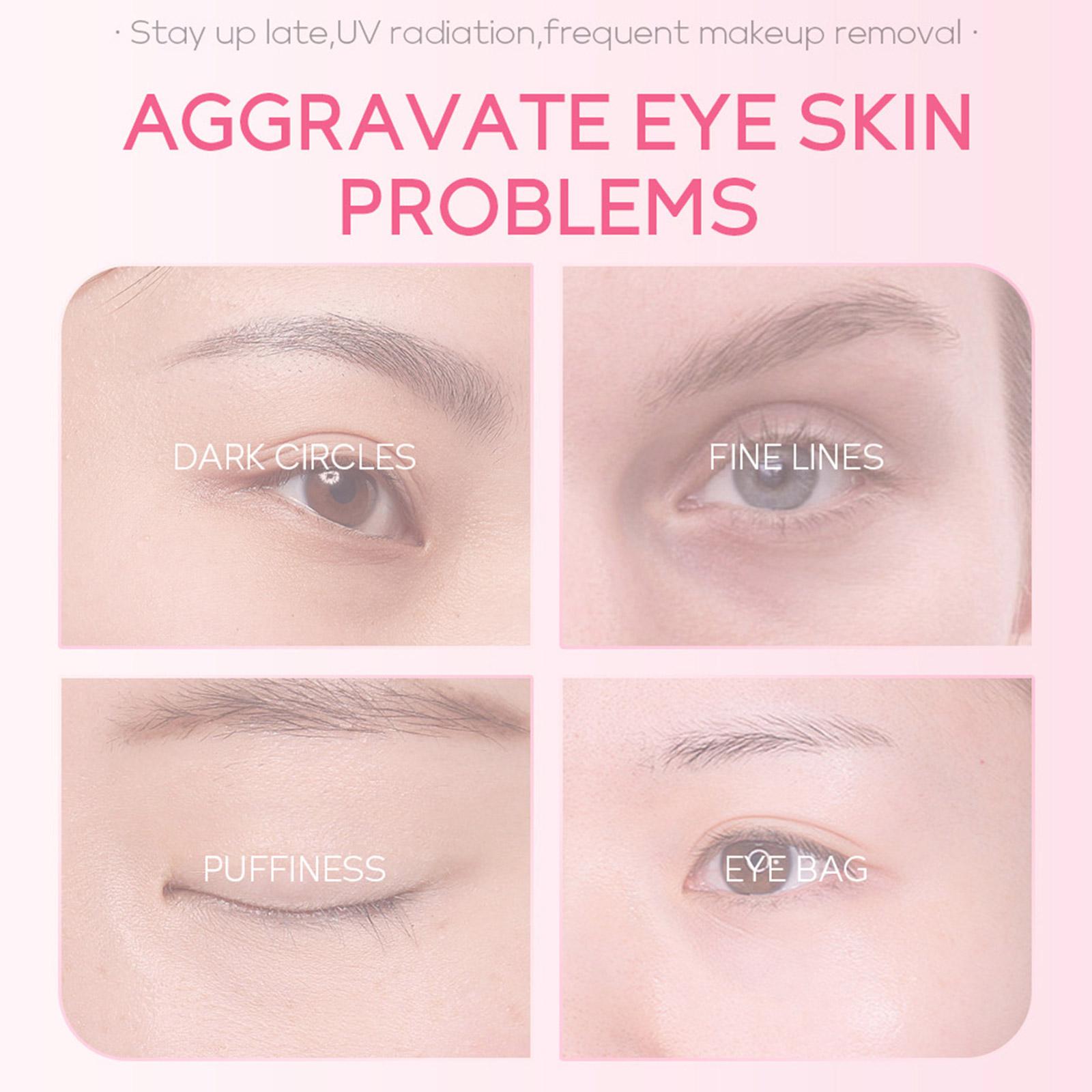 1/3/5pcs Sakura Eye Essence cr - Women Bags Under Eyes บทวิจารณ์และราคา