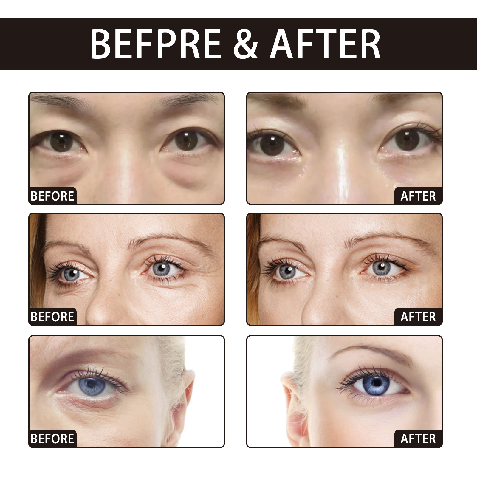 OUHOE Retinol Eye Cream Anti-W - Women Bags Under Eyes บทวิจารณ์และราคา